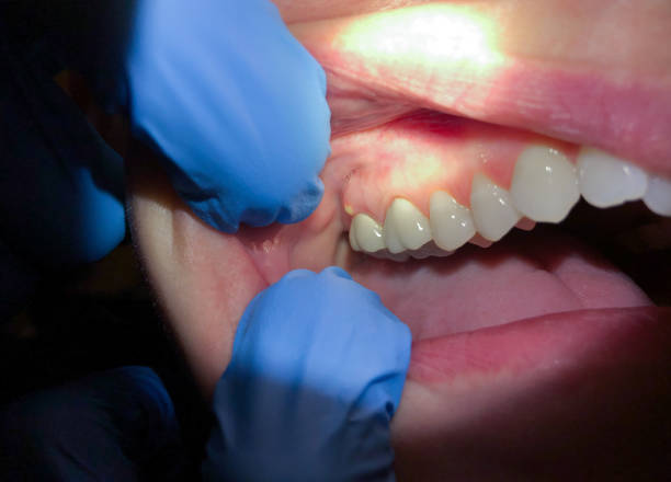 Best After-Hours Dental Trauma Care in Harleigh, PA