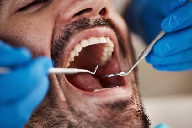 Best Emergency Gum Treatment in Harleigh, PA